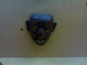 Thyrotoxicosis-in National Museum.